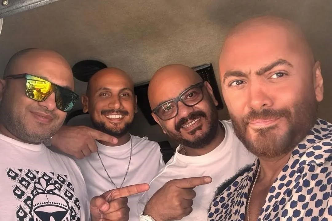 Tamer Hosny’s new look is turning heads! What do you think of his bold transformation.